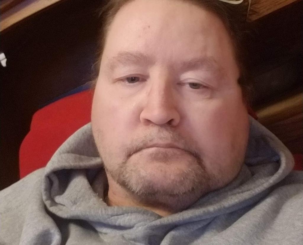 Wounded Man Picture World War 1 | Scenes From World War 1 | Wounded